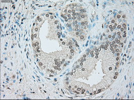 GFAP Antibody - IHC of paraffin-embedded prostate tissue using anti-GFAP mouse monoclonal antibody. (Dilution 1:50).