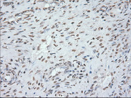 GFAP Antibody - IHC of paraffin-embedded Ovary tissue using anti-GFAP mouse monoclonal antibody. (Dilution 1:50).