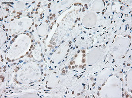 GFAP Antibody - IHC of paraffin-embedded thyroid tissue using anti-GFAP mouse monoclonal antibody. (Dilution 1:50).