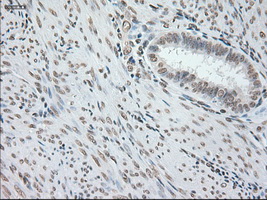 GFAP Antibody - IHC of paraffin-embedded endometrium tissue using anti-GFAP mouse monoclonal antibody. (Dilution 1:50).
