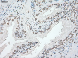 GFAP Antibody - IHC of paraffin-embedded prostate tissue using anti-GFAP mouse monoclonal antibody. (Dilution 1:50).