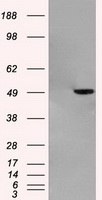 GFAP Antibody - HEK293T cells were transfected with the pCMV6-ENTRY control (Left lane) or pCMV6-ENTRY GFAP (Right lane) cDNA for 48 hrs and lysed. Equivalent amounts of cell lysates (5 ug per lane) were separated by SDS-PAGE and immunoblotted with anti-GFAP.