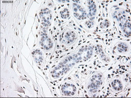 GFAP Antibody - IHC of paraffin-embedded breast tissue using anti-GFAP mouse monoclonal antibody. (Dilution 1:50).