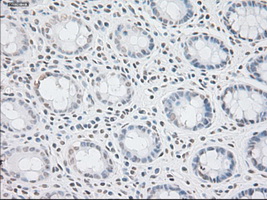 GFAP Antibody - IHC of paraffin-embedded colon tissue using anti-GFAP mouse monoclonal antibody. (Dilution 1:50).