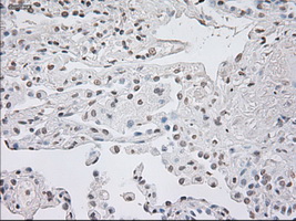 GFAP Antibody - IHC of paraffin-embedded lung tissue using anti-GFAP mouse monoclonal antibody. (Dilution 1:50).