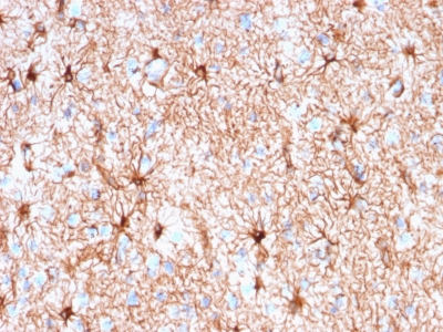 GFAP Antibody - Formalin-fixed, paraffin-embedded human Cerebellum stained with GFAP Mouse Recombinant Monoclonal Antibody (rASTRO/789).