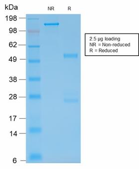 GFAP Antibody - SDS-PAGE Analysis Purified GFAP Mouse Recombinant Monoclonal Antibody (rASTRO/789). Confirmation of Purity and Integrity of Antibody.