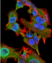 GFAP Antibody - Detection of GFAP in neuroblastoma cell line SK-N-BE with GFAP Monoclonal Antibody at 10ug/ml: DAPI (blue) nuclear stain, Texas Red F actin stain, ATTO 488 (green) GFAP stain.