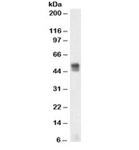GFAP Antibody - Western blot testing of U87 MG cell lysate (glioblastoma) with Glial Fibrillary Acidic Protein antibody (clone SPM248). Expected molecular weight 50~55kDa, lower bands are thought to be proteolytic fragments or alternate transcripts from the single gene. This image was taken for the unmodified form of this product. Other forms have not been tested.