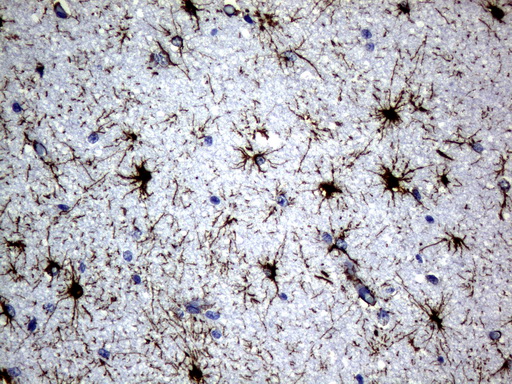 GFAP Antibody - Immunohistochemical staining of paraffin-embedded Human embryonic brain cortex tissue using anti-GFAP mouse monoclonal antibody.  heat-induced epitope retrieval by 10mM citric buffer, pH6.0, 120C for 3min)