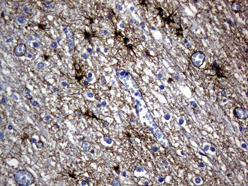 GFAP Antibody - Immunohistochemical staining of paraffin-embedded Human embryonic cerebellum using anti-GFAP mouse monoclonal antibody.  heat-induced epitope retrieval by 10mM citric buffer, pH6.0, 120C for 3min)