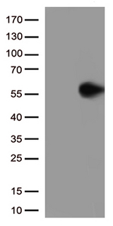 GFAP Antibody - HEK293T cells were transfected with the pCMV6-ENTRY control. (Left lane) or pCMV6-ENTRY GFAP. (Right lane) cDNA for 48 hrs and lysed. Equivalent amounts of cell lysates. (5 ug per lane) were separated by SDS-PAGE and immunoblotted with anti-GFAP. (1:500)