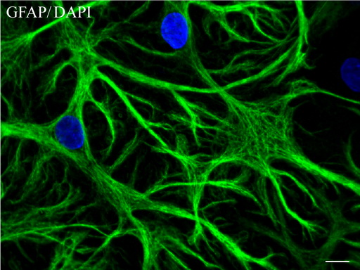 GFAP Antibody - Confocal immunofluoresce image of primary rat neurons labeled with anti-GFAP mouse monoclonal antibody  green, 1:100) and with DAPI. (blue) for nuclear. Scale bar, 10um.