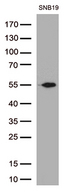 GFAP Antibody - Western blot analysis of extracts. (35ug) from 1 cell line lysate and 1 tissue lysate by using anti-GFAP monoclonal antibody. (1:500)