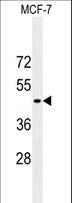 GFAP Antibody - GFAP Antibody western blot of MCF-7 cell line lysates (35 ug/lane). The GFAP antibody detected the GFAP protein (arrow).