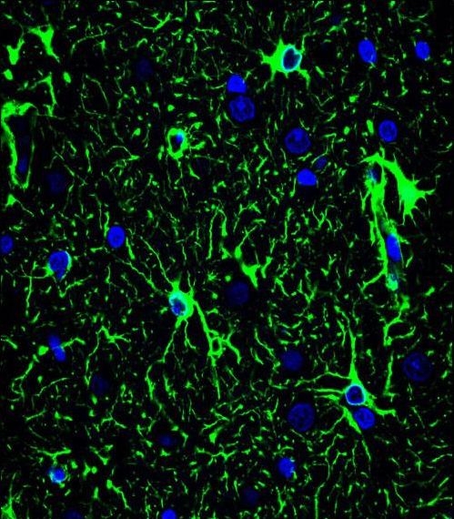 GFAP Antibody - Confocal immunofluorescence of GFAP Antibody with brain tissue followed by Alexa Fluor 488-conjugated goat anti-mouse lgG (green). DAPI was used to stain the cell nuclear (blue).