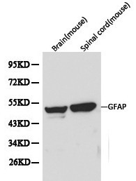 GFAP Antibody - Western blot of GFAP pAb in extracts from mouse brain and spinal cord tissues.