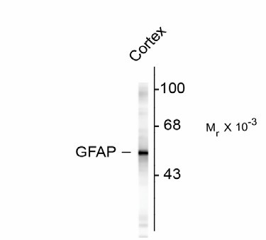 GFAP Antibody - Western Blot of GFAP antibody. Western blot of rat cortex lysate showing specific immunolabeling of ~50k GFAP protein