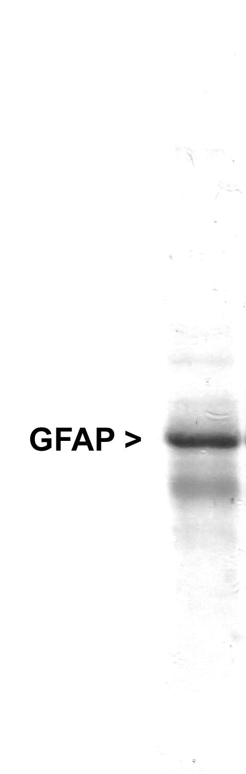 GFAP Antibody - Western blot of whole rat cerebellum homogenate stained with GFAP antibody, at dilution of 1:100000. A prominent band running with an apparent SDS-PAGE molecular weight of ~50kDa corresponds to rodent GFAP. A lower band at ~45kDa is derived from the GFAP molecule.