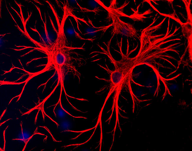 GFAP Antibody - Mixed cultures of neurons and glia stained with GFAP antibody (red), and DNA (blue). Astrocytes stain strongly and specifically in a clearly filamentous fashion with this antibody.