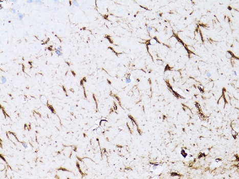 GFAP Antibody - Immunohistochemistry of paraffin-embedded rat brain using GFAP antibodyat dilution of 1:75 (40x lens).