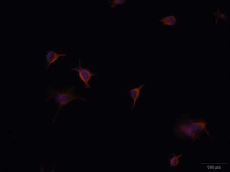 GFAP Antibody - Immunofluorescence analysis of U-251MG cells using GFAP antibodyat dilution of 1:100 (40x lens). Blue: DAPI for nuclear staining.