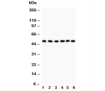 GFAP Antibody - Western blot testing of GFAP antibody and Lane 1: rat brain; 2: mouse brain; 3: U87; 4: SHG-44 (human glioma line); 5: NEURO; 6: HeLa lysate