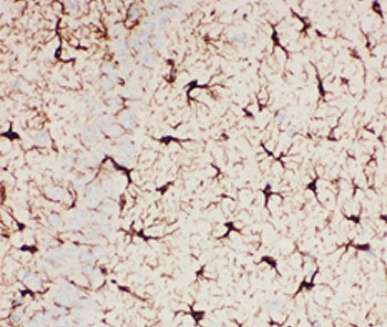 GFAP Antibody - IHC-P: GFAP antibody testing of mouse brain tissue