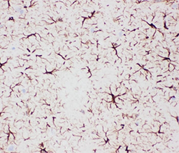 GFAP Antibody - IHC-P: GFAP antibody testing of rat brain tissue