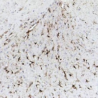 GFAP Antibody - Immunohistochemical analysis of GFAP staining in rat brain formalin fixed paraffin embedded tissue section. The section was pre-treated using heat mediated antigen retrieval with sodium citrate buffer (pH 6.0). The section was then incubated with the antibody at room temperature and detected using an HRP conjugated compact polymer system. DAB was used as the chromogen. The section was then counterstained with hematoxylin and mounted with DPX.