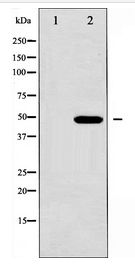 GFAP Antibody - Western blot of GFAP expression in COLO205 whole cell lysates,The lane on the left is treated with the antigen-specific peptide.