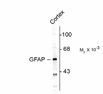 GFAP Antibody - Western blot of rat cortex lysate showing specific immunolabeling of the ~50k GFAP protein.