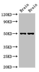 GFAP Antibody - Western Blot Positive WB detected in:Mouse brain tissue,Rat brain tissue All Lanes:Gfap antibody at 2.7µg/ml Secondary Goat polyclonal to rabbit IgG at 1/50000 dilution Predicted band size: 50,49 KDa Observed band size: 50 KDa