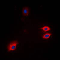 GFAP Antibody - Immunofluorescent analysis of GFAP staining in HeLa cells. Formalin-fixed cells were permeabilized with 0.1% Triton X-100 in TBS for 5-10 minutes and blocked with 3% BSA-PBS for 30 minutes at room temperature. Cells were probed with the primary antibody in 3% BSA-PBS and incubated overnight at 4 deg C in a humidified chamber. Cells were washed with PBST and incubated with a DyLight 594-conjugated secondary antibody (red) in PBS at room temperature in the dark. DAPI was used to stain the cell nuclei (blue).