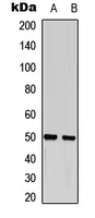 GFAP Antibody - Western blot analysis of GFAP (pS38) expression in COLO205 (A); mouse brain (B) whole cell lysates.
