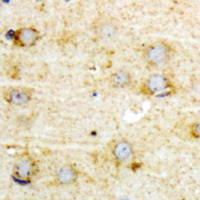 GFAP Antibody - Immunohistochemical analysis of GFAP (pS38) staining in human brain formalin fixed paraffin embedded tissue section. The section was pre-treated using heat mediated antigen retrieval with sodium citrate buffer (pH 6.0). The section was then incubated with the antibody at room temperature and detected using an HRP conjugated compact polymer system. DAB was used as the chromogen. The section was then counterstained with hematoxylin and mounted with DPX.