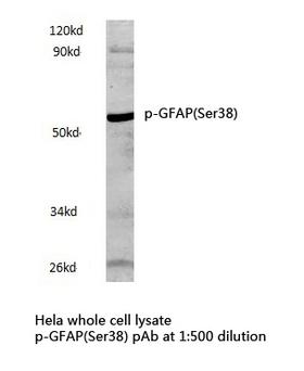 GFAP Antibody - Western blot of p-GFAP(Ser38) pAb in extracts from HeLa cells and rat brain tissue.