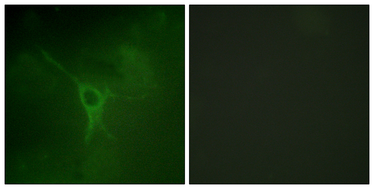 GFAP Antibody - Immunofluorescence analysis of COS7 cells, using GFAP (Phospho-Ser38) Antibody. The picture on the right is blocked with the phospho peptide.
