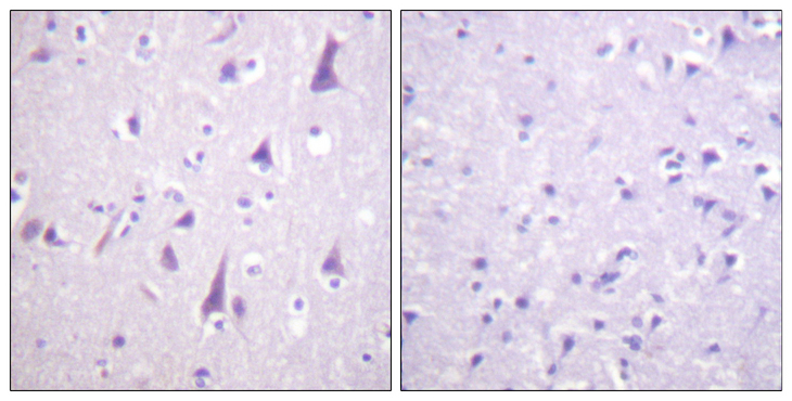 GFAP Antibody - Immunohistochemistry analysis of paraffin-embedded human brain, using GFAP (Phospho-Ser38) Antibody. The picture on the right is blocked with the phospho peptide.