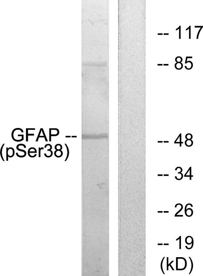 GFAP Antibody - Western blot analysis of lysates from HeLa cells, using GFAP (Phospho-Ser38) Antibody. The lane on the right is blocked with the phospho peptide.