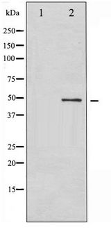 GFAP Antibody - Western blot of GFAP phosphorylation expression in HeLa whole cell lysates,The lane on the left is treated with the antigen-specific peptide.