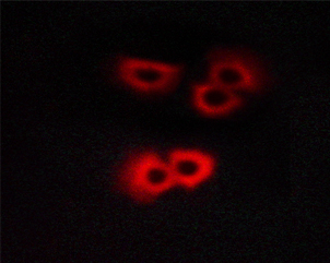 GFAP Antibody - Staining COS cells by IF/ICC. The samples were fixed with PFA and permeabilized in 0.1% saponin prior to blocking in 10% serum for 45 min at 37°C. The primary antibody was diluted 1/400 and incubated with the sample for 1 hour at 37°C. A Alexa Fluor® 594 conjugated goat polyclonal to rabbit IgG (H+L), diluted 1/600 was used as secondary antibody.