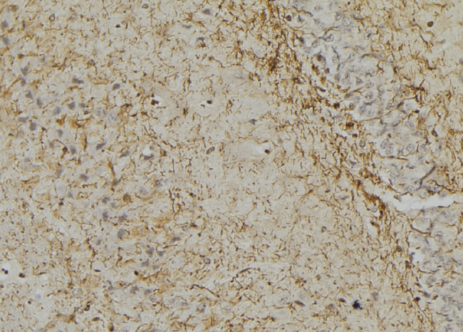 GFAP Antibody - 1:100 staining mouse brain tissue by IHC-P. The sample was formaldehyde fixed and a heat mediated antigen retrieval step in citrate buffer was performed. The sample was then blocked and incubated with the antibody for 1.5 hours at 22°C. An HRP conjugated goat anti-rabbit antibody was used as the secondary.