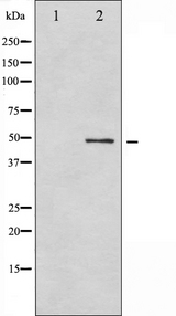 GFAP Antibody - Western blot analysis of GFAP phosphorylation expression in HeLa whole cells lysates. The lane on the left is treated with the antigen-specific peptide.