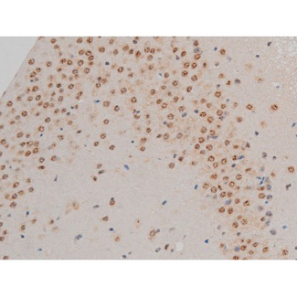 GFAP Antibody - 1:200 staining mouse brain tissue by IHC-P. The tissue was formaldehyde fixed and a heat mediated antigen retrieval step in citrate buffer was performed. The tissue was then blocked and incubated with the antibody for 1.5 hours at 22°C. An HRP conjugated goat anti-rabbit antibody was used as the secondary.