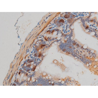 GFAP Antibody - 1:200 staining mouse intestinal tissue by IHC-P. The tissue was formaldehyde fixed and a heat mediated antigen retrieval step in citrate buffer was performed. The tissue was then blocked and incubated with the antibody for 1.5 hours at 22°C. An HRP conjugated goat anti-rabbit antibody was used as the secondary.