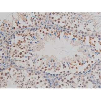 GFAP Antibody - 1:200 staining mouse testis tissue by IHC-P. The tissue was formaldehyde fixed and a heat mediated antigen retrieval step in citrate buffer was performed. The tissue was then blocked and incubated with the antibody for 1.5 hours at 22°C. An HRP conjugated goat anti-rabbit antibody was used as the secondary.