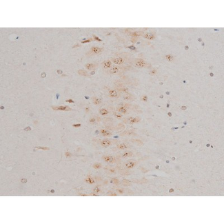 GFAP Antibody - 1:200 staining rat brain tissue by IHC-P. The tissue was formaldehyde fixed and a heat mediated antigen retrieval step in citrate buffer was performed. The tissue was then blocked and incubated with the antibody for 1.5 hours at 22°C. An HRP conjugated goat anti-rabbit antibody was used as the secondary.
