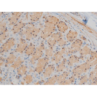 GFAP Antibody - 1:200 staining rat ganstric tissue by IHC-P. The tissue was formaldehyde fixed and a heat mediated antigen retrieval step in citrate buffer was performed. The tissue was then blocked and incubated with the antibody for 1.5 hours at 22°C. An HRP conjugated goat anti-rabbit antibody was used as the secondary.