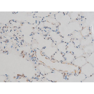 GFAP Antibody - 1:200 staining rat lung tissue by IHC-P. The tissue was formaldehyde fixed and a heat mediated antigen retrieval step in citrate buffer was performed. The tissue was then blocked and incubated with the antibody for 1.5 hours at 22°C. An HRP conjugated goat anti-rabbit antibody was used as the secondary.